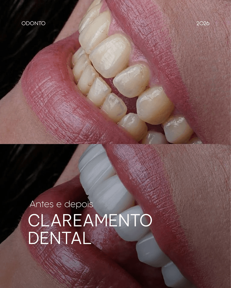 Caso clínico de Estructura y diseño labial — Dra. Margaret Narváez